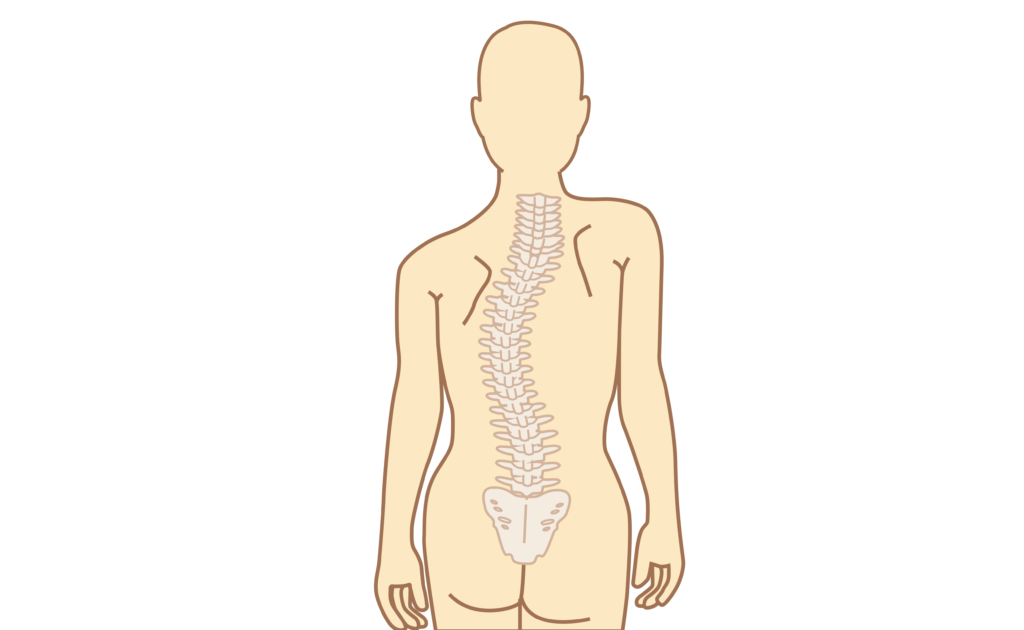 Сколиоз у детей может быть врожденным или приобретенным