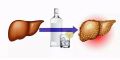 Алкоголь и гепатит С — смертельное сочетание